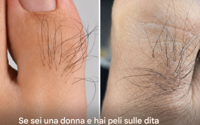 Molte donne non sanno cosa rivelano i peli delle dita dei piedi. Scopri di più