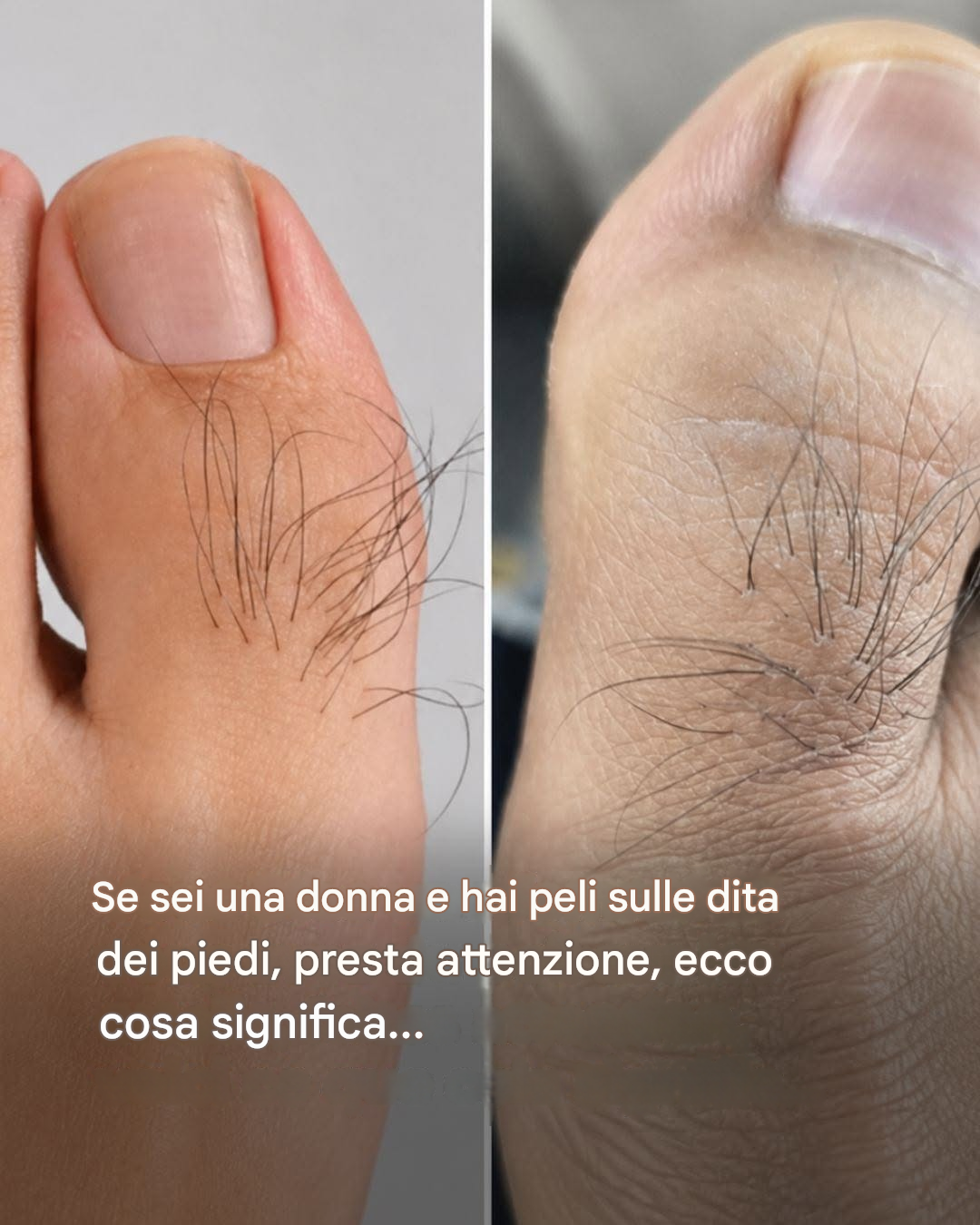 Molte donne non sanno cosa rivelano i peli delle dita dei piedi. Scopri di più