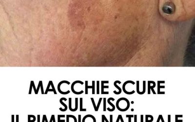 Aggiungilo alla tua crema e le macchie sul viso saranno un lontano ricordo