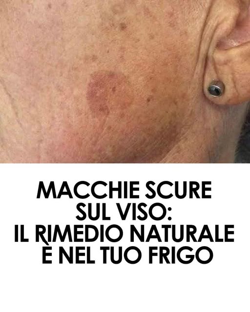 Aggiungilo alla tua crema e le macchie sul viso saranno un lontano ricordo