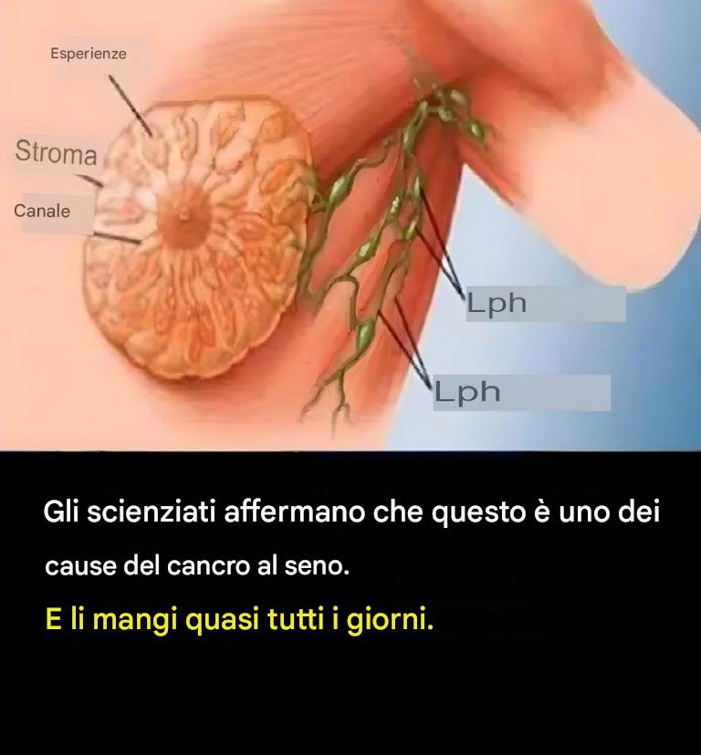 Il 90% dei casi di cancro al seno potrebbe essere prevenuto se le donne seguissero queste 9 regole
