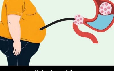 10 cibi che ti fanno ingrassare la pancia