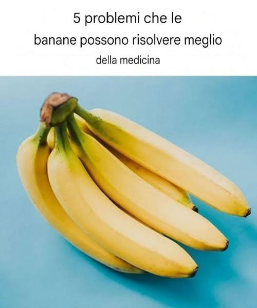 5 problemi che le banane possono risolvere meglio della medicina a