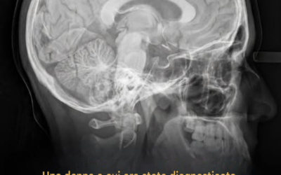 📢 Demenza o carenza vitaminica? Una storia che ti ricorda di non arrenderti mai  🤔 I medici pensavano avesse la demenza: cosa hanno scoperto?