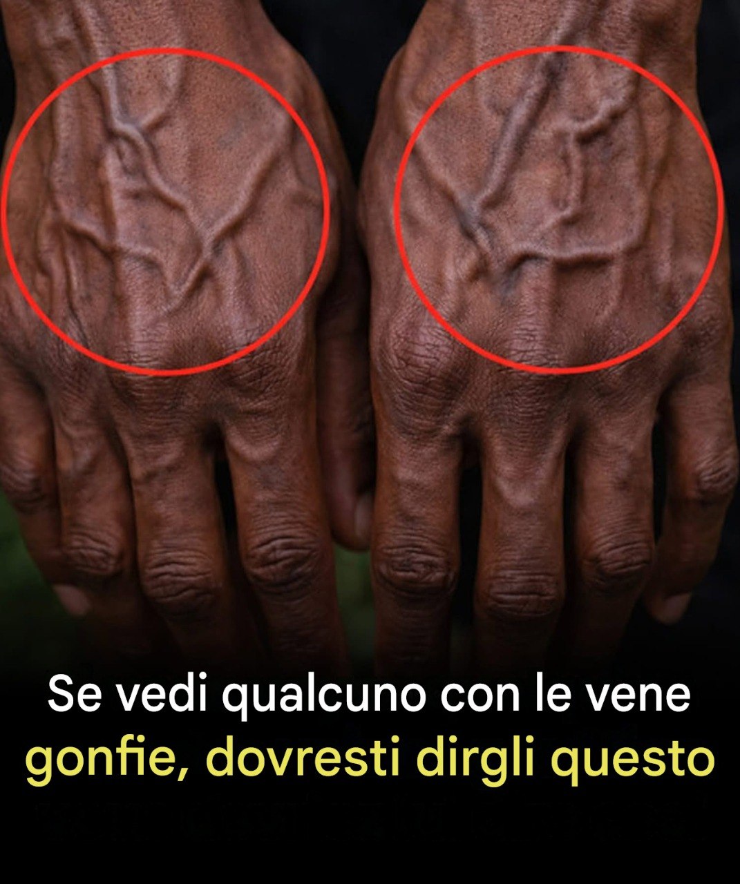 Se le tue vene sono visibili, significa che sei… Vedi altro
