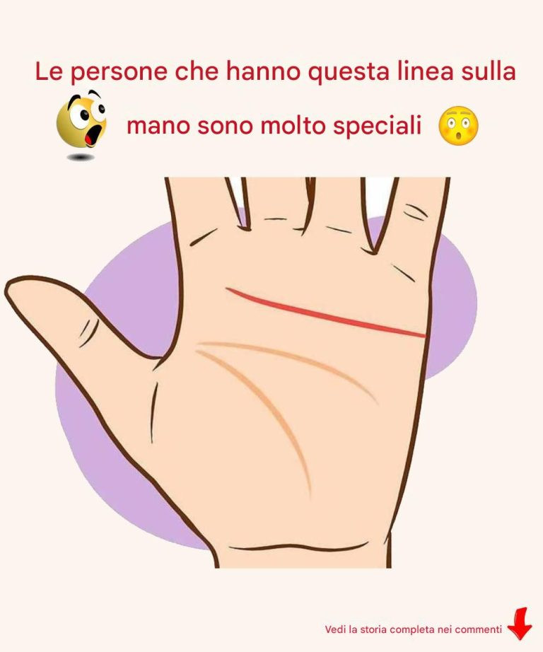 Le persone che hanno questa linea sulla mano sono molto speciali.