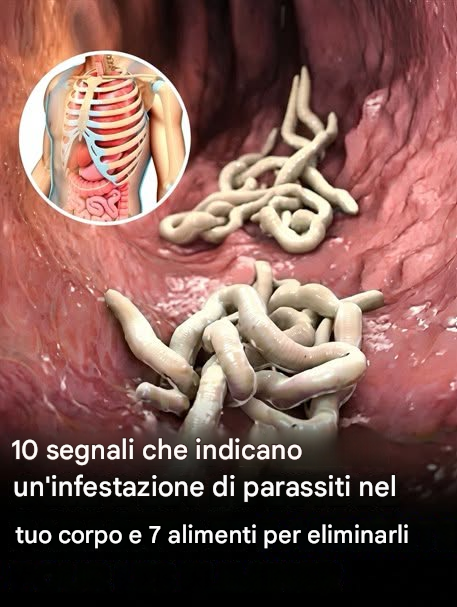Il tuo corpo potrebbe ospitare parassiti senza che tu te ne accorga.  Leggi il primo commento qui sotto 👇