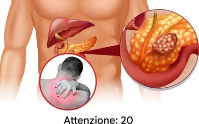20 segnali di allarme precoce se il tuo corpo sta combattendo contro una malattia