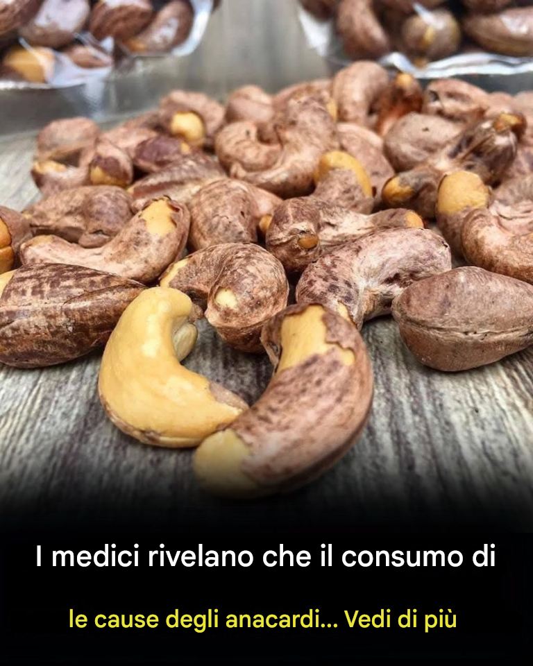 I medici rivelano che mangiare anacardi provoca…