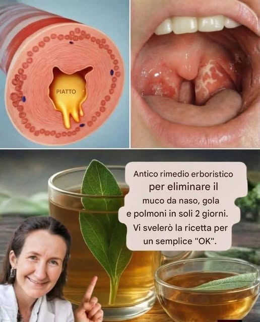 Rimedio erboristico ancestrale per rimuovere il muco da naso, gola e polmoni in soli 2 giorni.