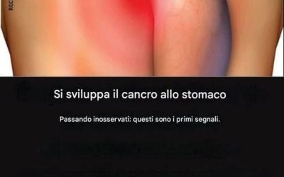 Il cancro allo stomaco viene distrutto dalla forma latente: ecco i primi sintomi!