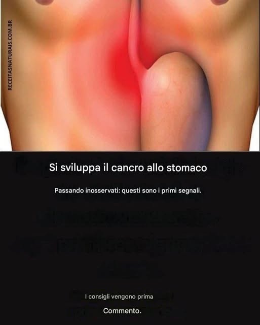 Il cancro allo stomaco viene distrutto dalla forma latente: ecco i primi sintomi!