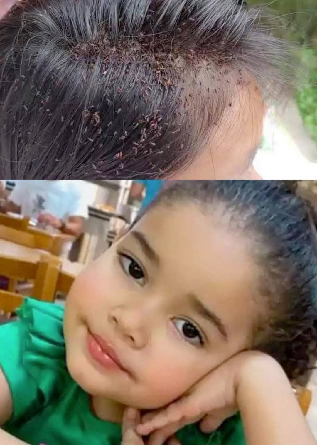 Una bambina di 3 anni muore a causa di un’infezione…Vedi altro