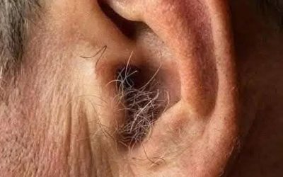 LO SAPEVI? Se ti crescono i peli nelle orecchie, è perché il tuo corpo…