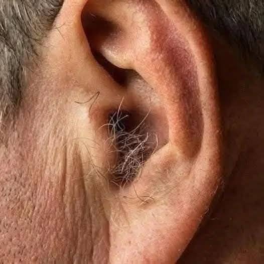 LO SAPEVI? Se ti crescono i peli nelle orecchie, è perché il tuo corpo…