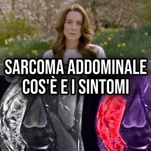 Kate e il cancro, il sintomo salva vita: fate molta attenzione se vi gr…Altro…