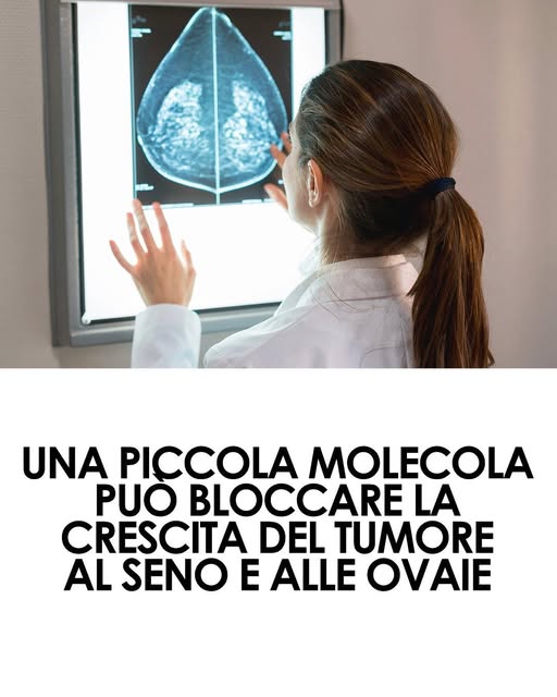 I ricercatori hanno scoperto la nuova molecola che potrebbe rivoluzionare il trattamento del tumore al seno e alle ovaie; presto inizieranno i test sull’uomo.