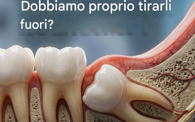 Ci hanno sempre detto che vanno estratti… Eppure, oltre il 67% delle estrazioni dei denti del giudizio sono completamente inutili. La verità su questa pratica a cui quasi tutti noi siamo stati sottoposti.
