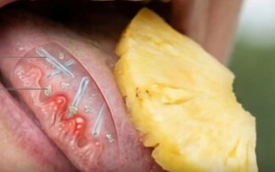 I medici rivelano che mangiare ananas può causare…Vedi altro