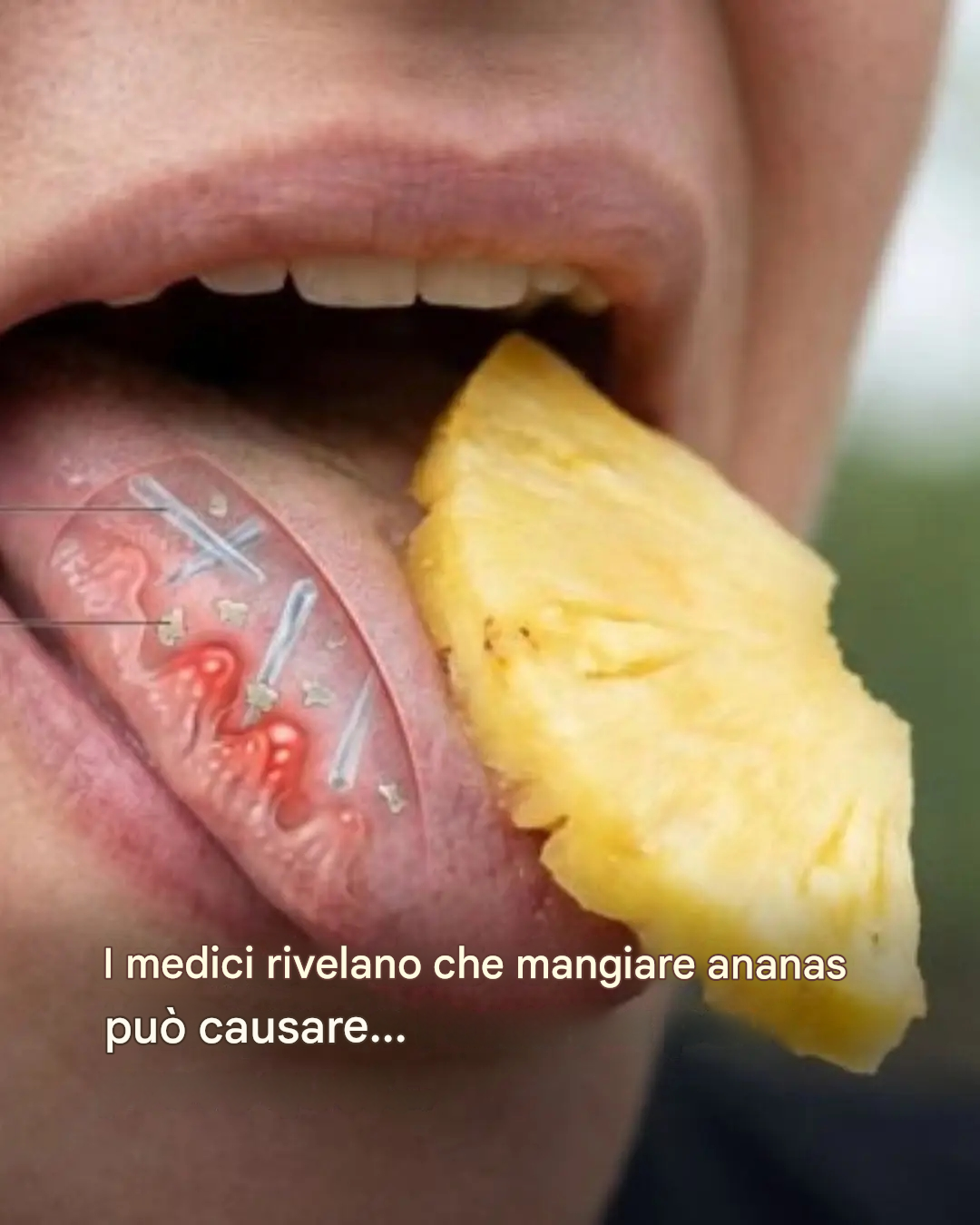 I medici rivelano che mangiare ananas può causare…Vedi altro