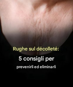Rughe sul décolleté: 5 consigli per prevenirle e ridurle