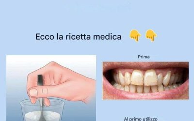 Rimuovi il tartaro dai denti e sbiancali con questa semplice ricetta.