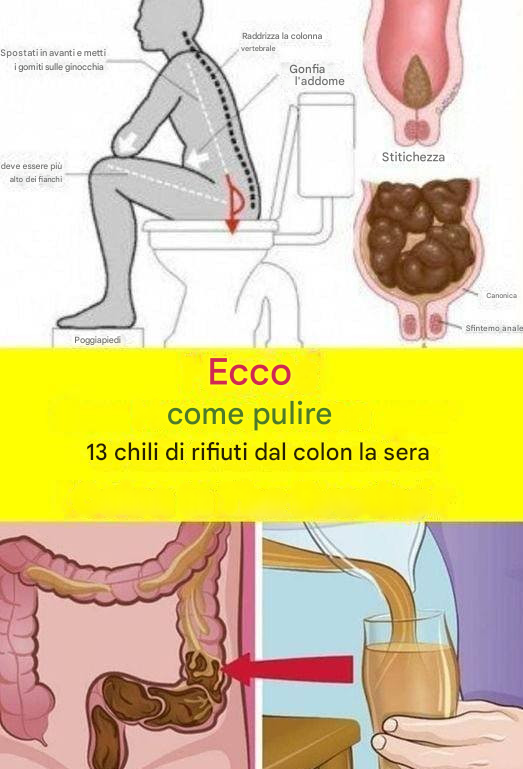 Scopri come eliminare 15 chili di rifiuti dal tuo colon in una notte