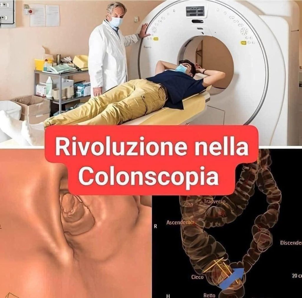 Nuova metodica, la Colonscopia non sarà più un esame invasivo (1 / 2)