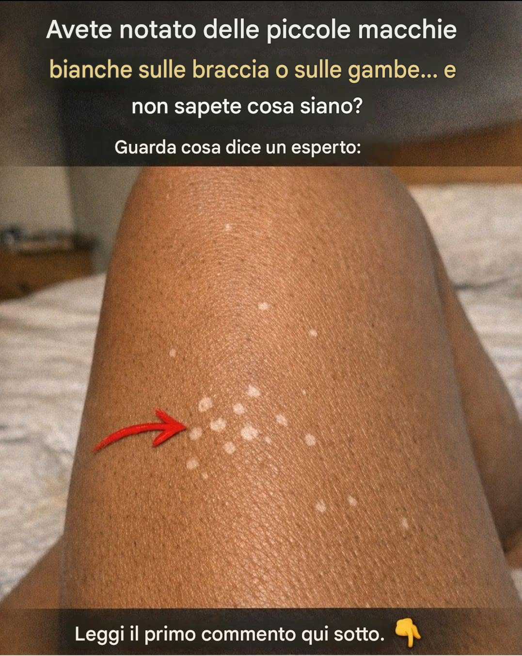 Perché compaiono delle maniche bianche sulla pelle?