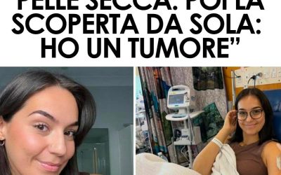 Tumore scoperto dopo mesi: il prurito ignorato dai medici e la diagnosi arrivata da sola