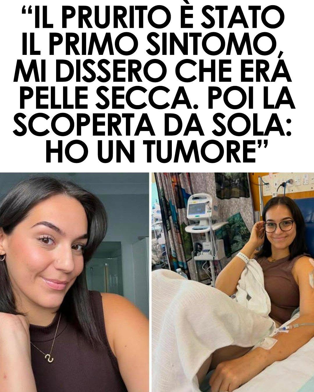 Tumore scoperto dopo mesi: il prurito ignorato dai medici e la diagnosi arrivata da sola