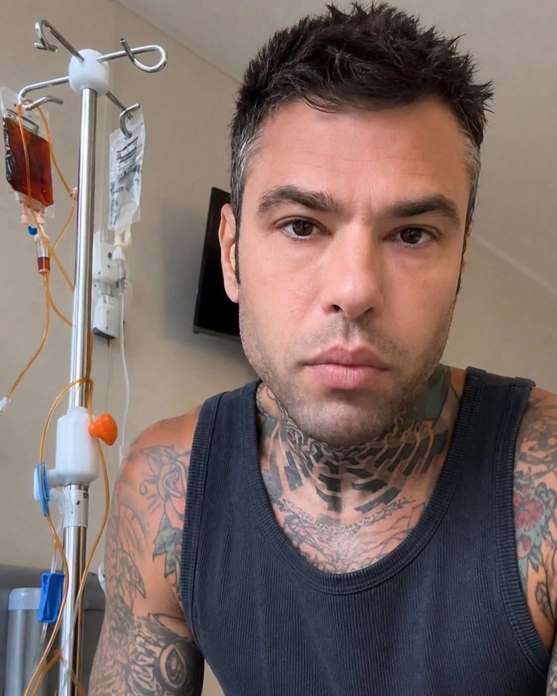 Fedez, l’annuncio poco fa: le sue condizioni