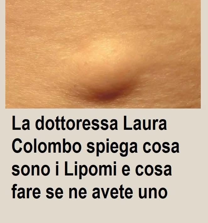 La dottoressa Laura Colombo spiega cosa sono i Lipomi e cosa fare se ne avete uno (1 / 2)