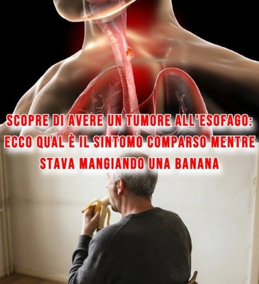Scopre di avere un tumore all’esofago: ecco qual è il sintomo comparso mentre stava mangiando una banana ⬇️⬇️