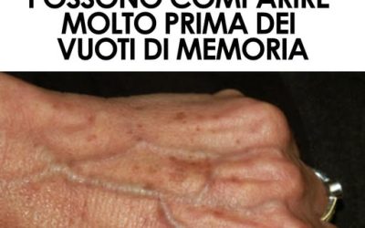 Demenza, la pelle può dare segnali molto prima dei vuoti di memoria. Ecco a cosa devi fare attenzione ⬇️