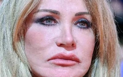 Paola Ferrari choc: “Sul viso ho un tum…Altro…