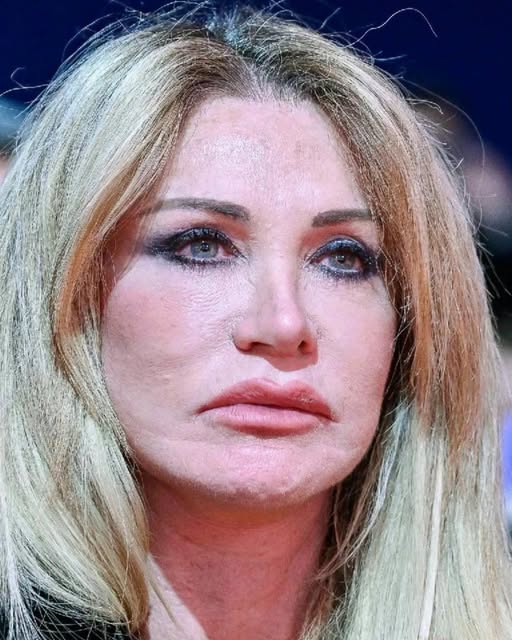 Paola Ferrari choc: “Sul viso ho un tum…Altro…