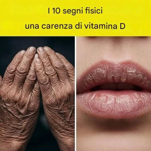 10 segni che il tuo corpo ha bisogno di vitamina D