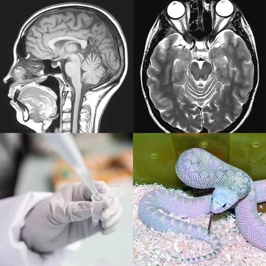 😱 “È vivo e si muove”. Nel cervello le hanno trovato un…Altro…
