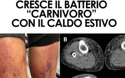 Rischi per ferite aperte e frutti di mare crudi, ma gli esperti invitano a non allarmarsi.⬇️