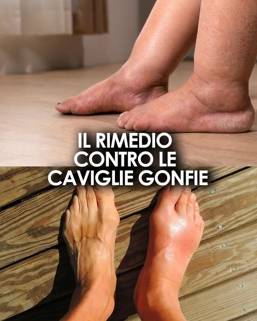 Immergi i piedi e versa un paio di cucchiai: sentirai sollievo subito. Non perderti questo rimedio ottimo se soffri di caviglie gonfie 👇