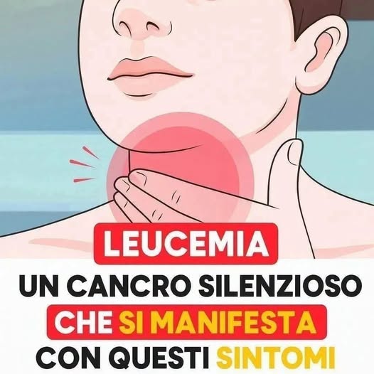 🔴 La leucemia si manifesta con questi 5 sint.. Altro…