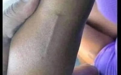 # Ho trovato questo sul braccio di mia figlia, sto ancora cercando di capire di cosa si tratta.
