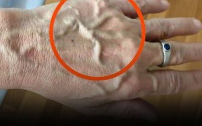 Se hai vene visibili significa che sei…