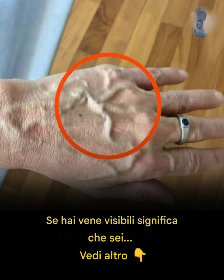 Se hai vene visibili significa che sei…