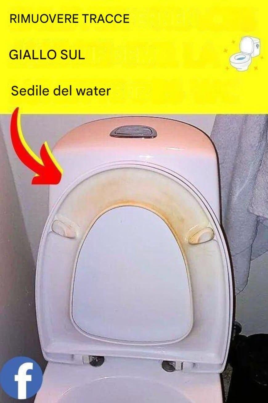 Il trucco per rimuovere le macchie gialle sul sedile del water