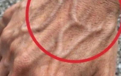Se hai vene visibili, significa che sei… Vedi altro