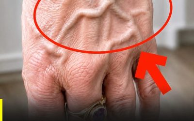 Sapevi che avere vene visibili significa che sei… Vedi di più
