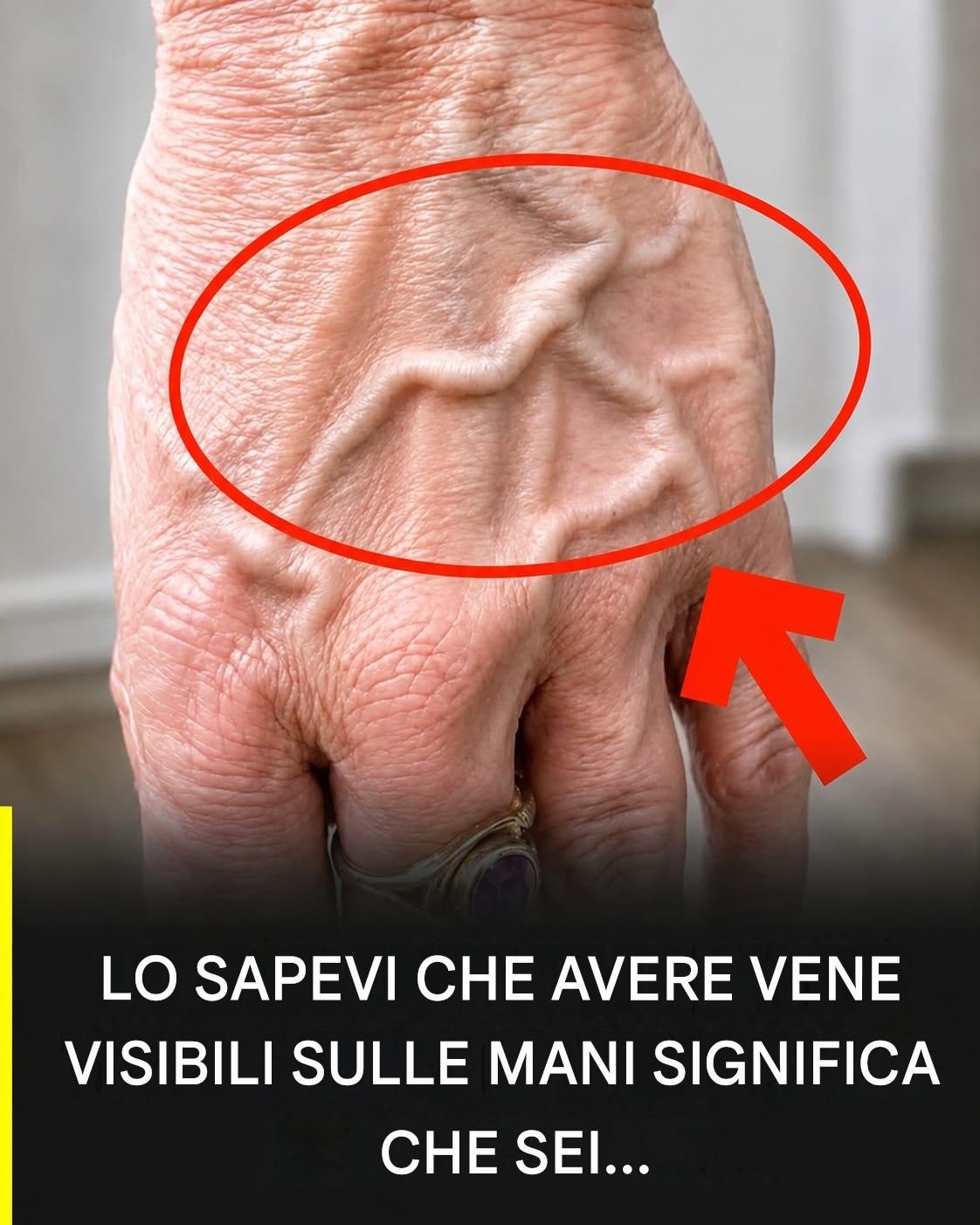 Sapevi che avere vene visibili significa che sei… Vedi di più
