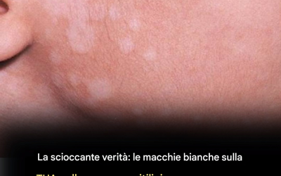 Esposizione al sole e alterazioni della pigmentazione: la verità nascosta dietro le piccole macchie bianche